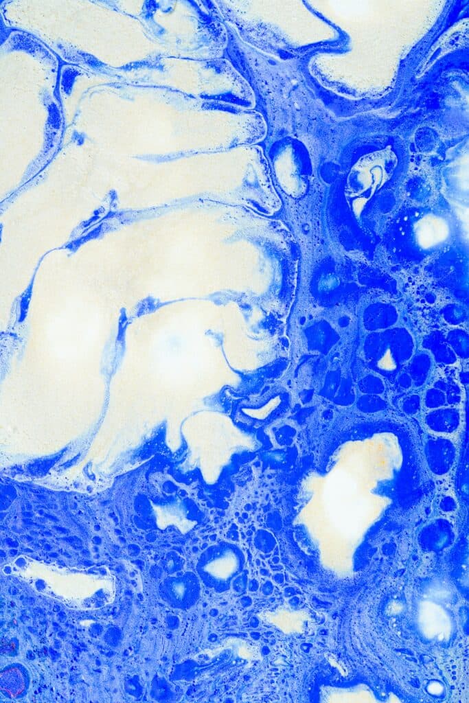 Osteosarcoma